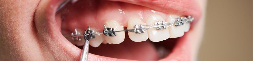 Ortodoncistas, clínicas de ortodoncia en provincia Lugo