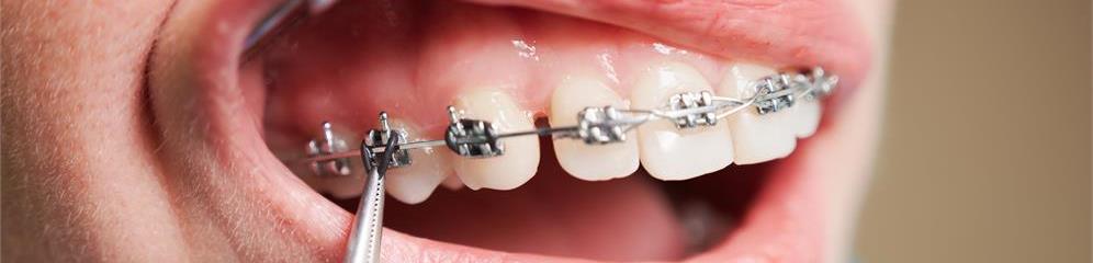 Ortodoncistas, clínicas de ortodoncia en provincia Ourense