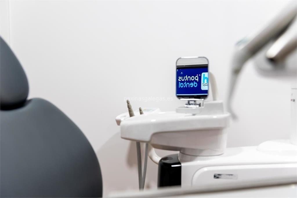 Pontus Dental imagen 12