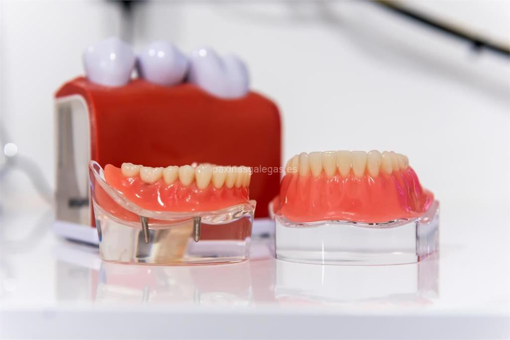 Pontus Dental imagen 18