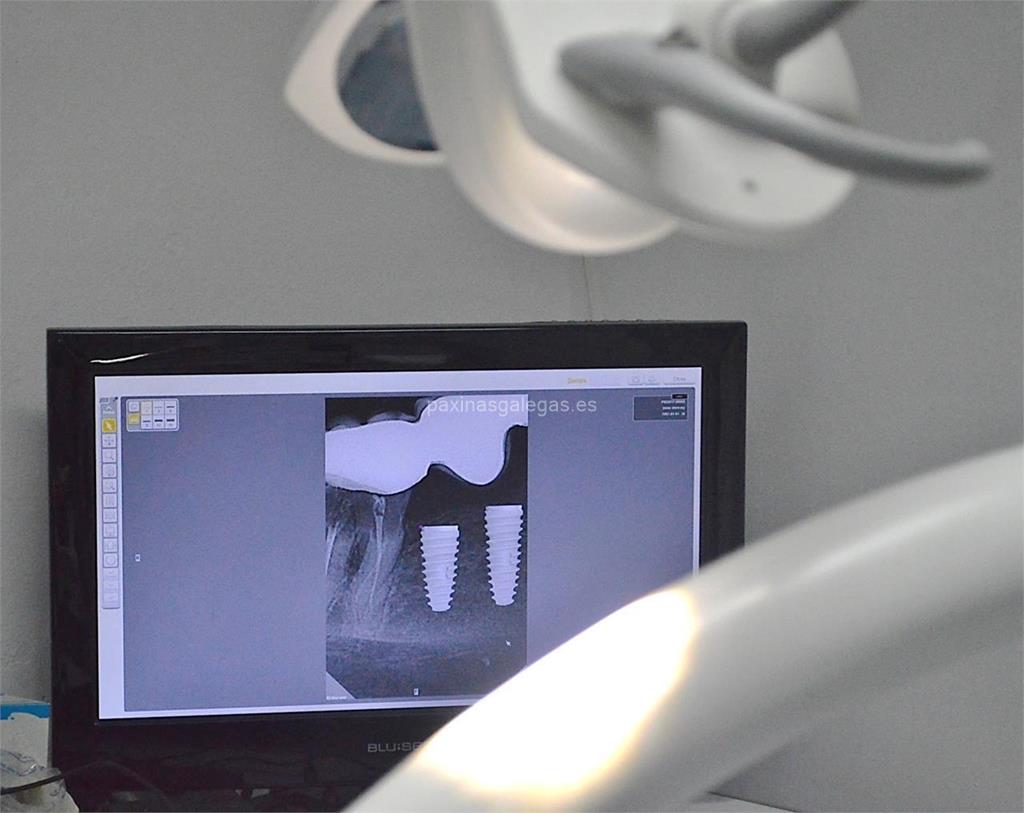 Rianxo Dental imagen 9