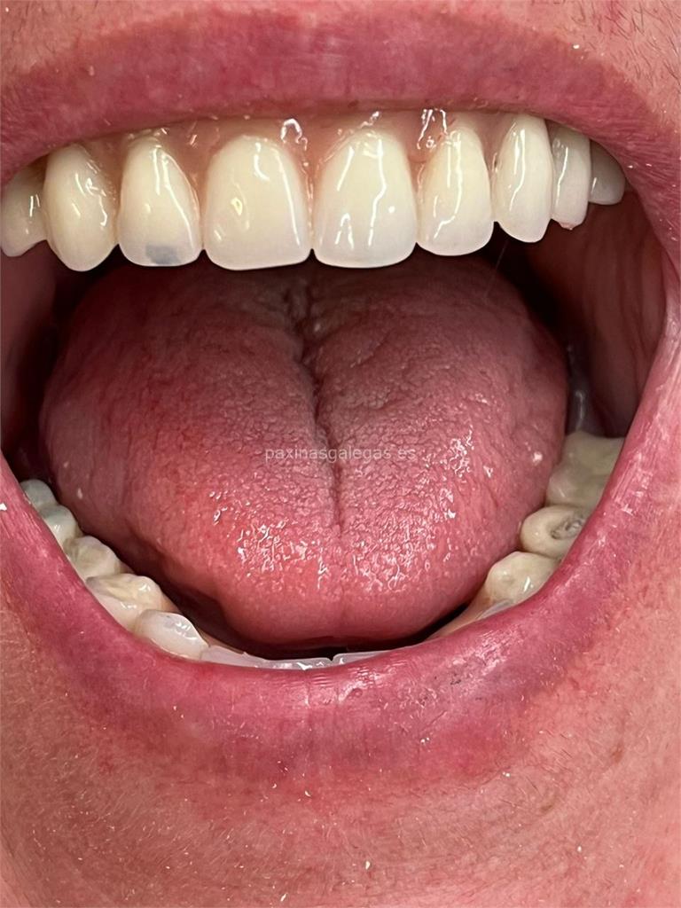 Titanium Clínica Dental & Estética imagen 16