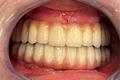 imagen 3 Titanium Clínica Dental & Estética
