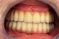 imagen 4 Titanium Clínica Dental & Estética