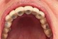 imagen 5 Titanium Clínica Dental & Estética
