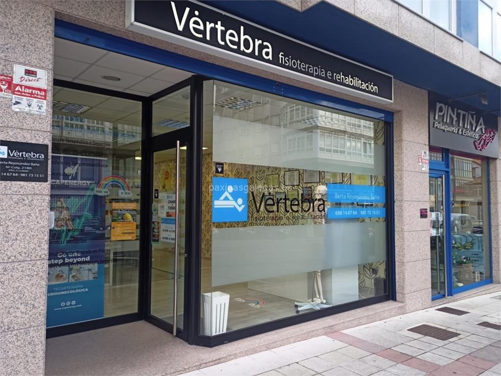 imagen principal Vértebra